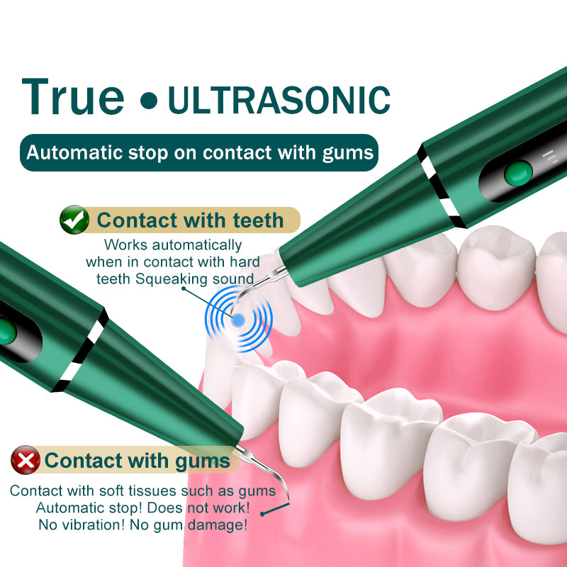 PERSMAX | Green High Power Ultrasonic Dental Calculus Remover 800Ah - PERSMAX