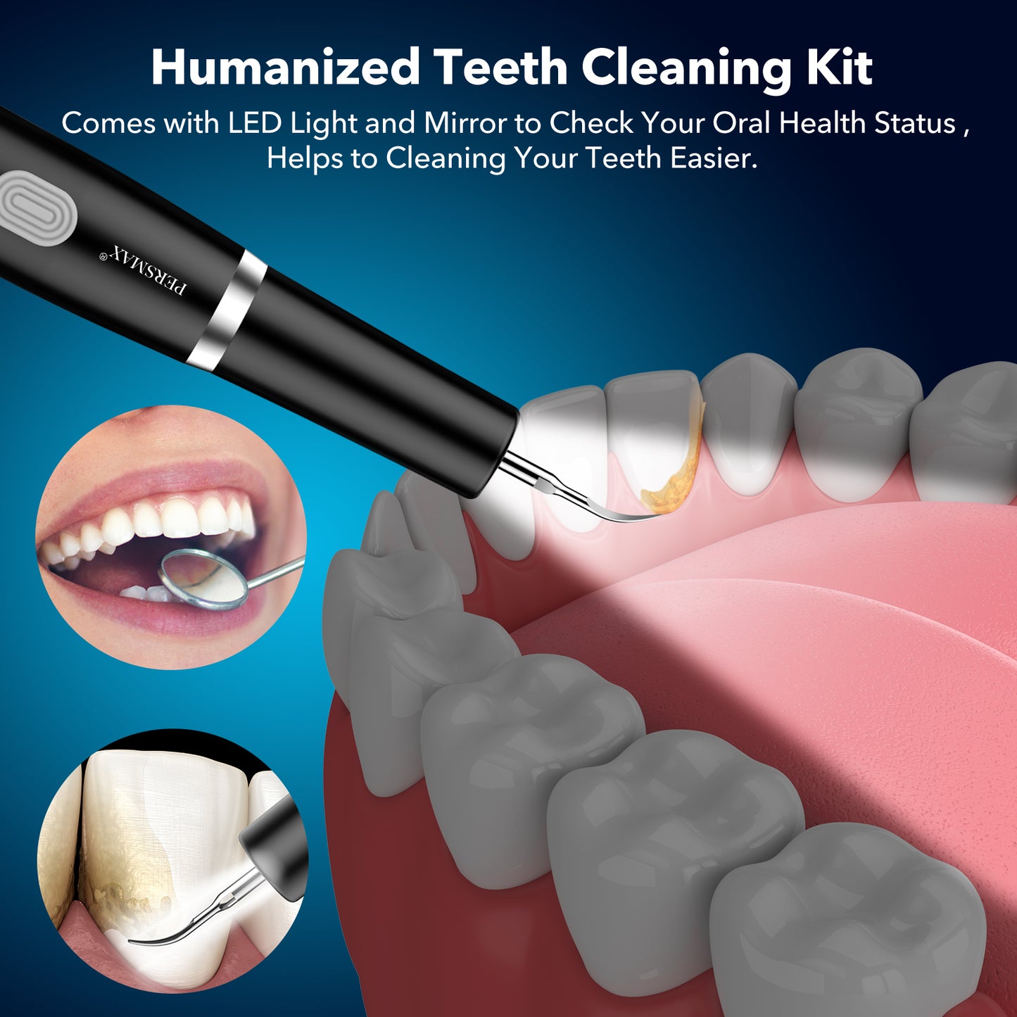 Black ultrasonic dental calculus remover