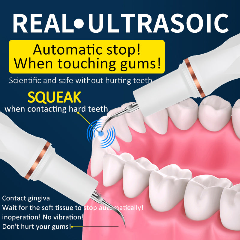 PERSMAX |White High Power Ultrasonic Dental Calculus Remover 1000Ah - PERSMAX