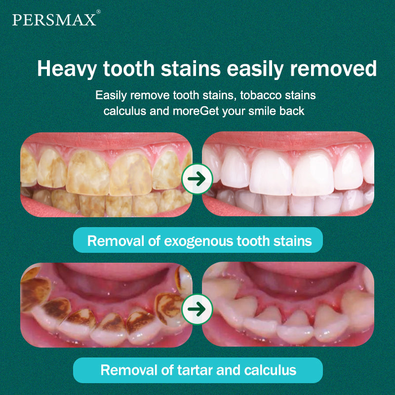 PERSMAX | Green High Power Ultrasonic Dental Calculus Remover 800Ah - PERSMAX
