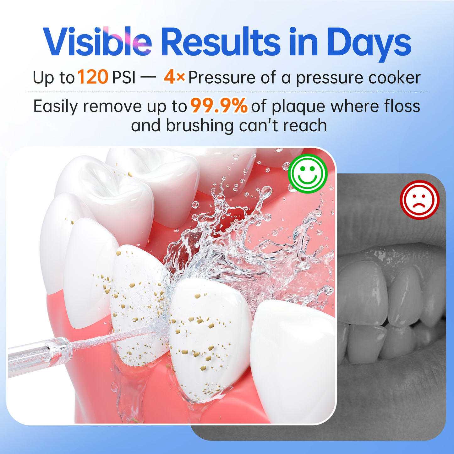 Water Flosser for Orthodontics Teeth Cleaning - Portable Electric Oral Irrigator Pick for Braces, Travel, Kids, with 3 Modes 8 Pressure Settings, 8 Tips, 150ML, IPX7, Gradient Blue