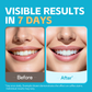PERSMAX Teeth Whitening Strips – Peroxide-Free Professional Dentist Approved, 14 Treatment, 28 Non-Slip Strips Kit, Express Whitening in 30-Min, Gum-Safe Formula, Easy to Use for Bright Smile - PERSMAX