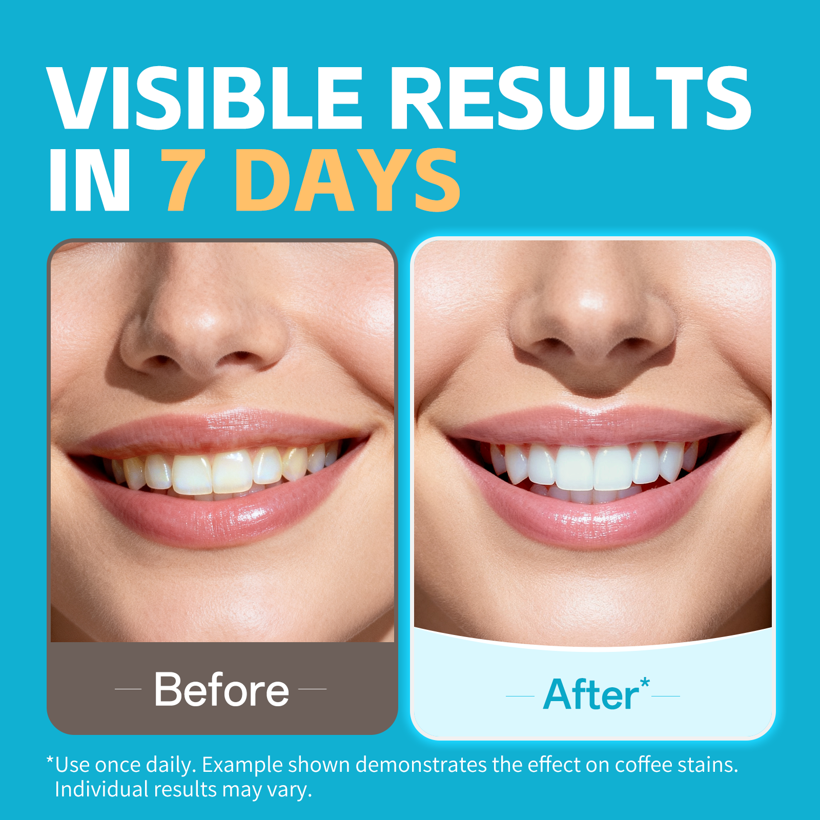 PERSMAX Teeth Whitening Strips – Peroxide-Free Professional Dentist Approved, 14 Treatment, 28 Non-Slip Strips Kit, Express Whitening in 30-Min, Gum-Safe Formula, Easy to Use for Bright Smile - PERSMAX