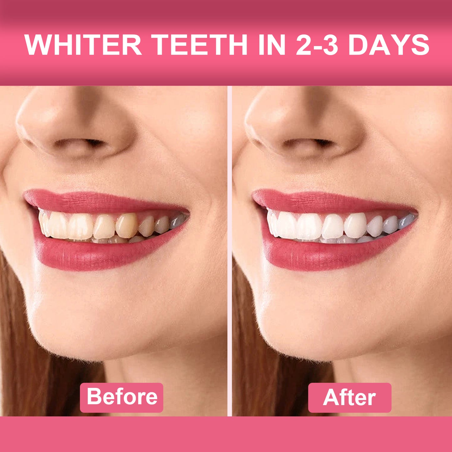 coconut oil teeth whitening strips